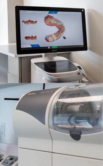 CEREC machine and monitor showing digital impression