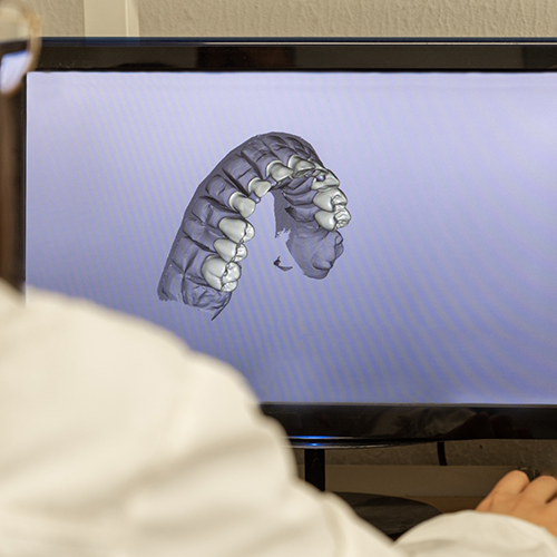 Monitor showing animation of teeth to plan Invisalign treatment