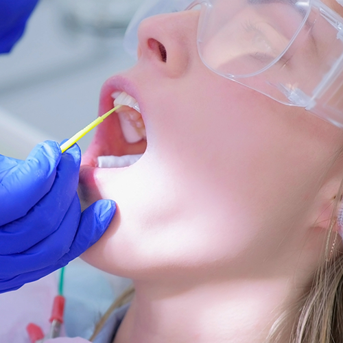 Woman opening mouth for fluoride treatment